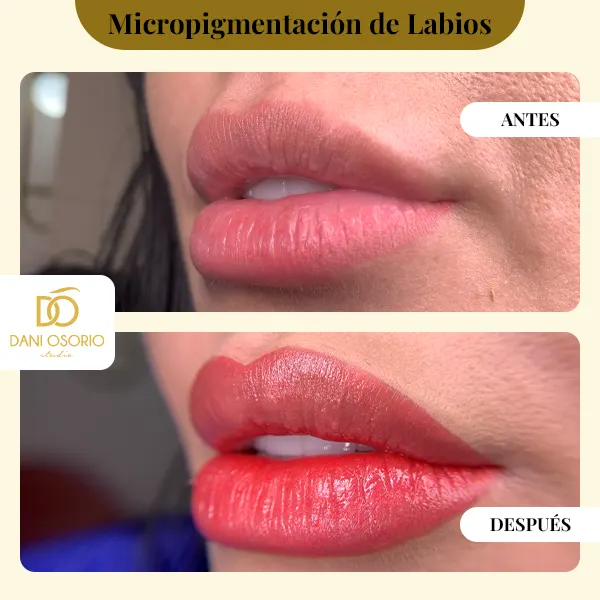 Img-DaniOsorio-Antes&Despues-Micropigmentación_de_Labios-1 Img-DaniOsorio-Antes&Despues-Micropigmentación_de_Labios-1