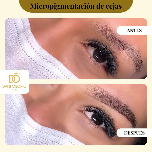 Img-DaniOsorio-Antes&Despues-Micropigmentación_de_cejas-1 Img-DaniOsorio-Antes&Despues-Micropigmentación_de_cejas-1